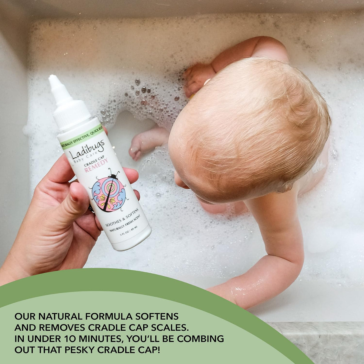 Ladibugs Cradle Cap Remedy Kit - 2-Step Serum & Comb Scale Remover