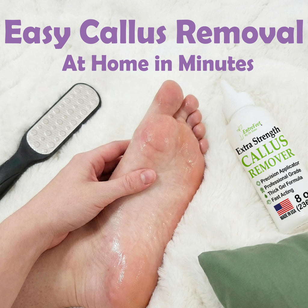 Foot Callus Remover Gel & File, 8 oz Extra Strength Callus Remover for Feet | Easily Softens and Removes Dead Hard Skin on Heels & Feet, Salon Results at Home in Minutes, Double-Sided Rasp Pedicure Tool