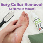 Foot Callus Remover Gel & File, 8 oz Extra Strength Callus Remover for Feet | Easily Softens and Removes Dead Hard Skin on Heels & Feet, Salon Results at Home in Minutes, Double-Sided Rasp Pedicure Tool
