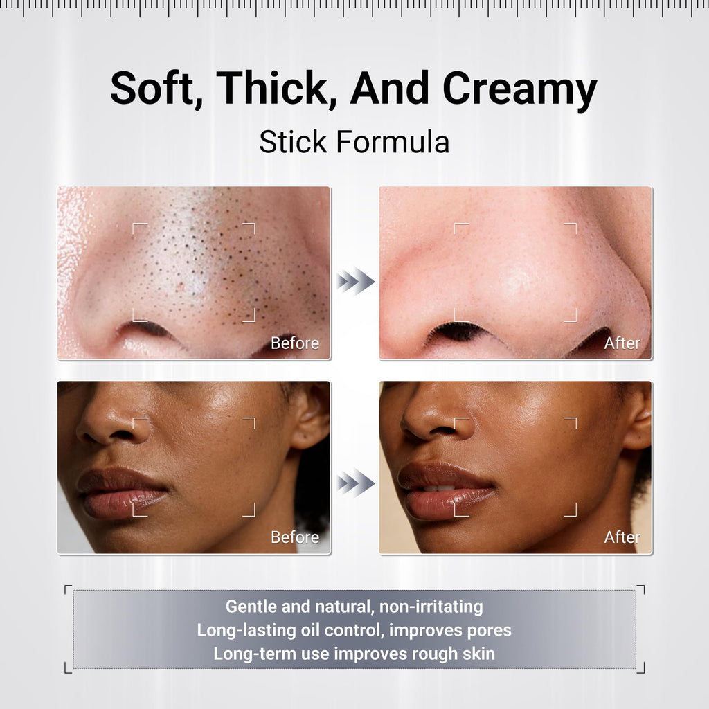 Blackhead Remover Clay Mask Stick, Volcanic Mud & Kaolin, 1.58oz