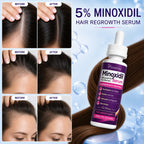 Minoxidil 5% Hair Regrowth Treatment for Women, 2-Month Supply | Topical Serum Drops for Thinning Hair, Revitalizes Hair Follicles, Reduces Hair Loss, Non-Greasy Liquid Formula