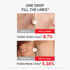 medicube NAD EGF Firming Serum for Face & Neck | Anti-Aging Serum with EGF Peptide, NAD+ & Collagen | Wrinkle Appearance, Elasticity & Pore Care | Korean Skincare, 1.01 fl.oz