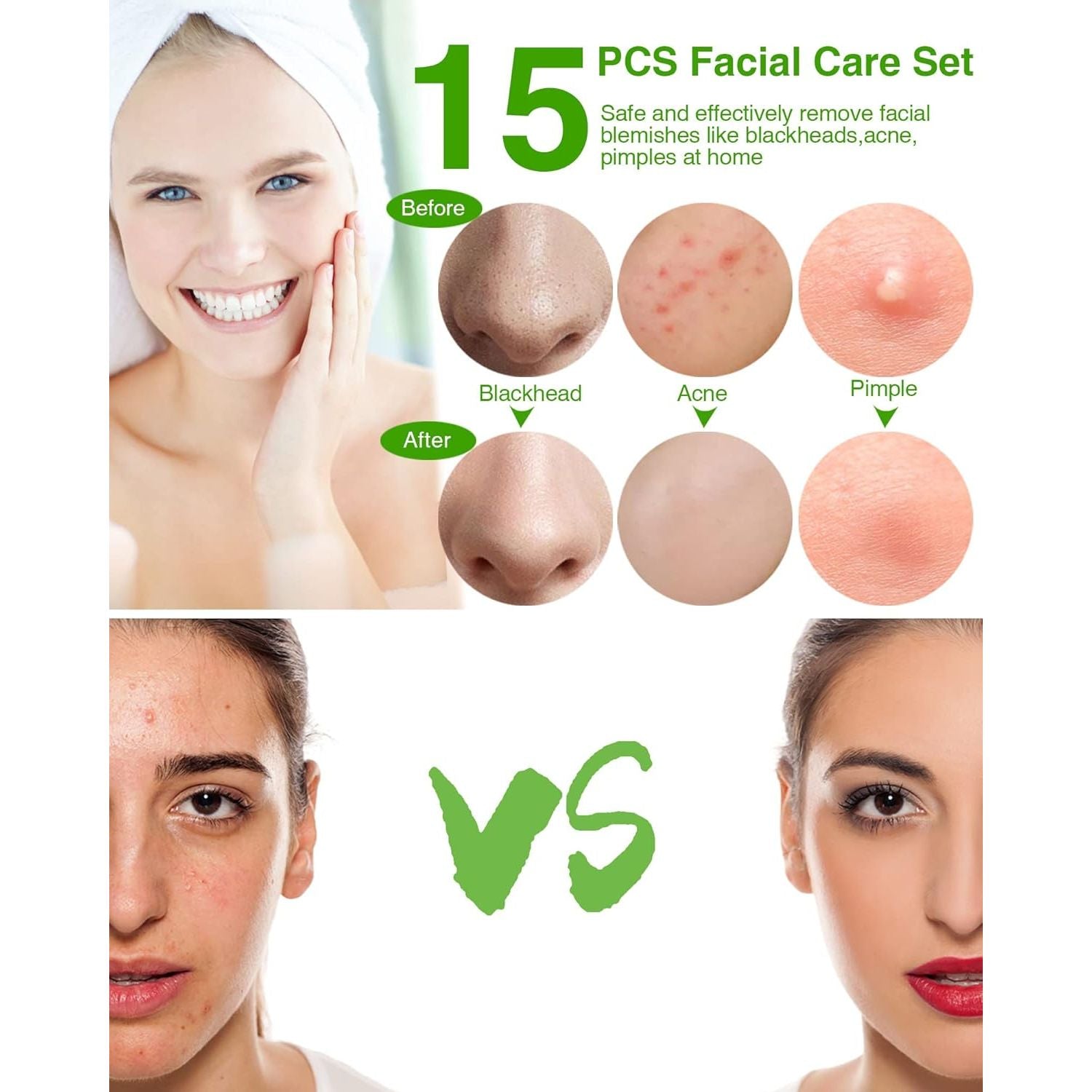 Buy now 15-Piece Blackhead Remover Tool Kit â€“ Pimple Popper & Acne Extractor Set for Whiteheads, Comedones & Blemishes | Facial Skin Care with Metal Case at indiglob india