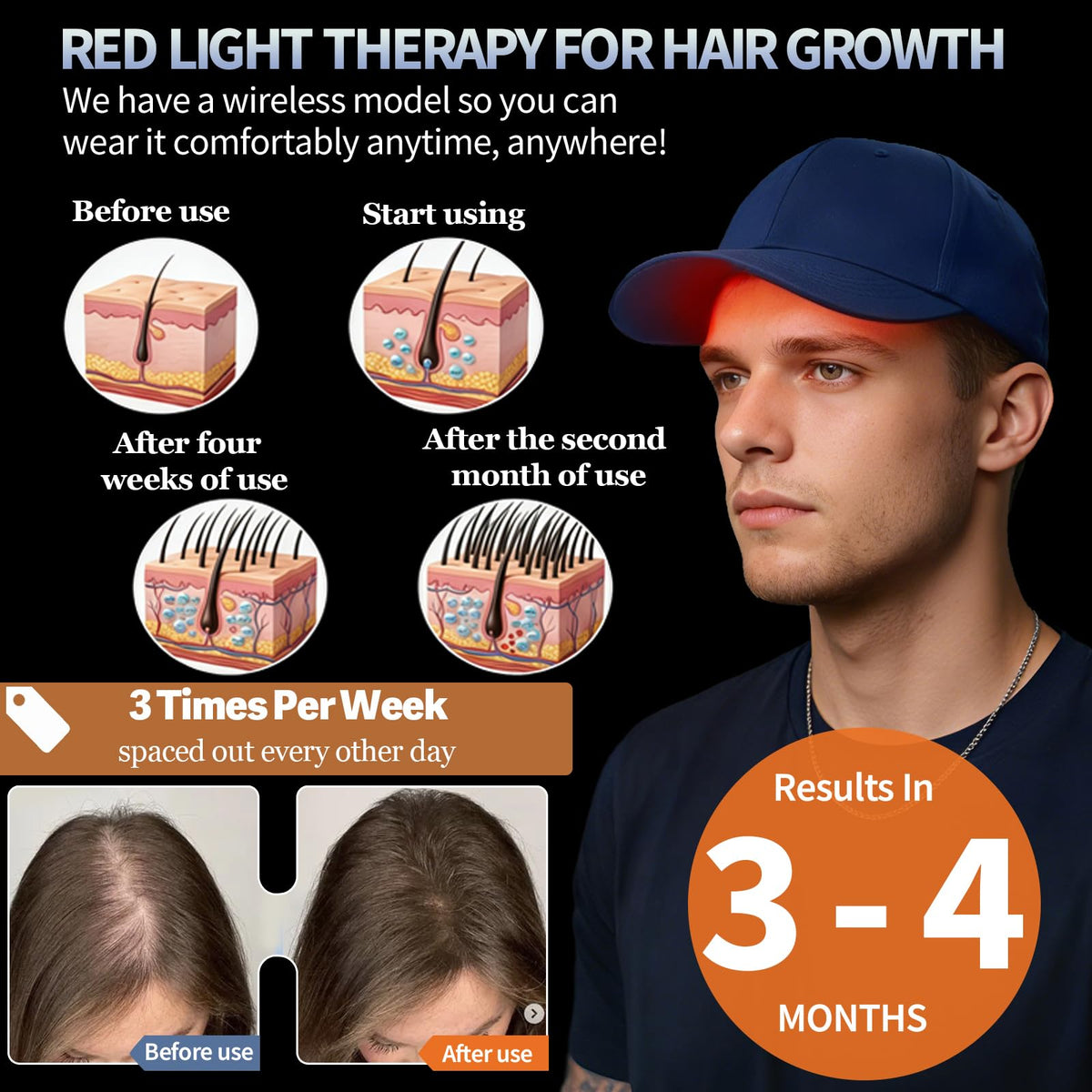 Red Light Therapy for Hair Cap, Hands-Free LLLT Laser Hair Growth Cap, Blue