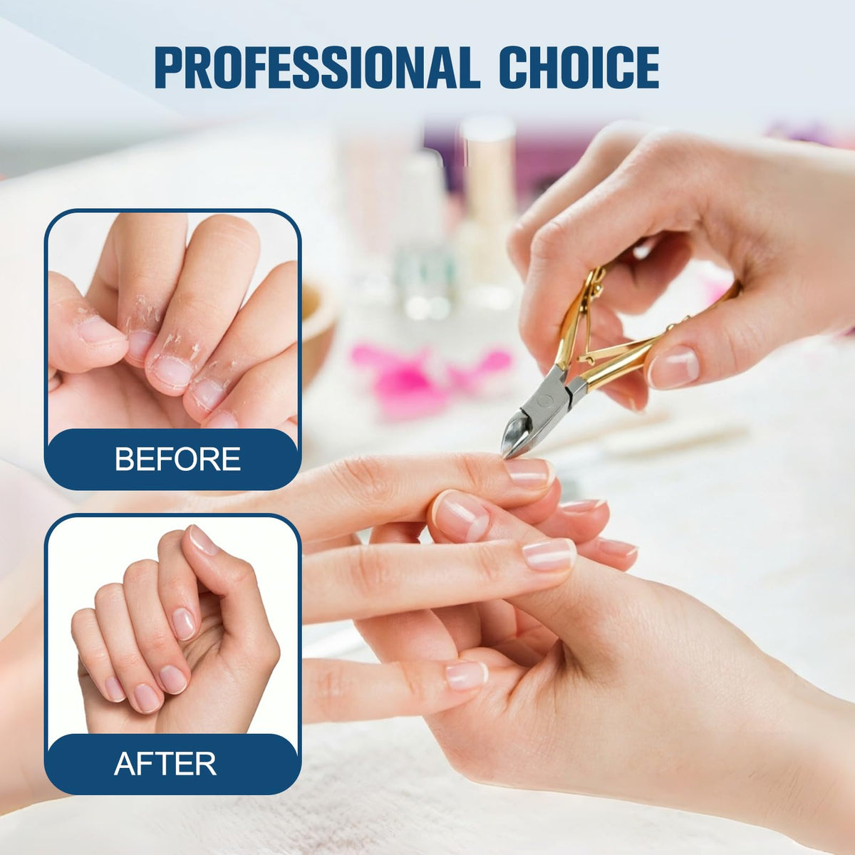 5 Packs Cuticle TrimmerKit, 7mm Jaw Cuticle Nippers