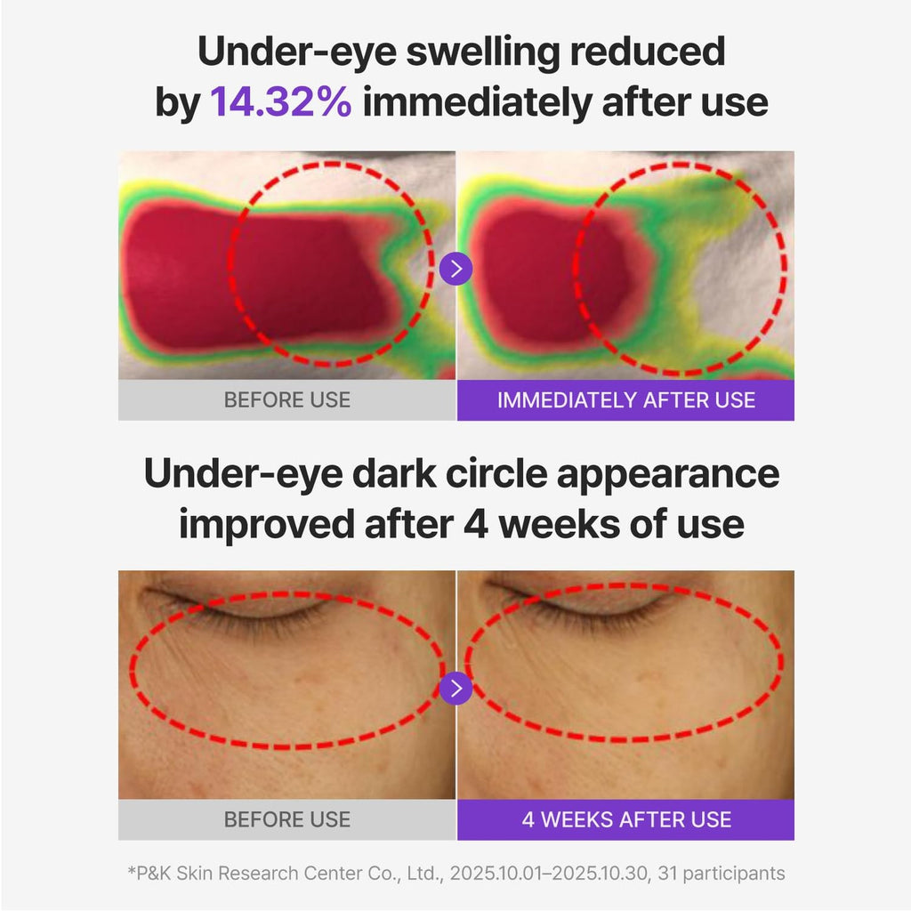 CENTELLIAN 24 360 Shot PDRN Glowing Eye Patch, TECA Dark Circles (6 Pairs)