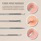 Teenitor 9 Pcs Professional Blackhead Tweezers and Pimple Popper Tool Kit, Stainless Steel Blackhead Remover Tools