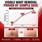 40% Salicylic Acid Wart Remover for Plantar Warts and All Types Wart