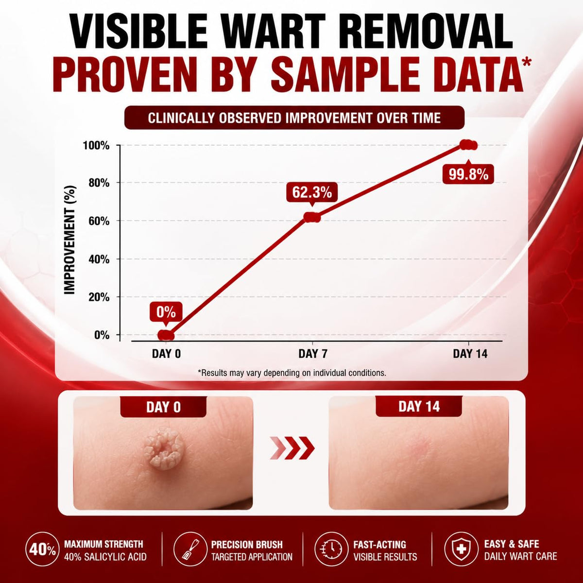 40% Salicylic Acid Wart Remover for Plantar Warts and All Types Wart