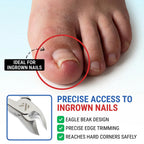 Toenail Clippers for Thick Toenails – KLIPP 15 mm Wide Jaw Thick Fingernail and Toenail Cutter with Curved Stainless-Steel Blades for Seniors (Eagle Beak)