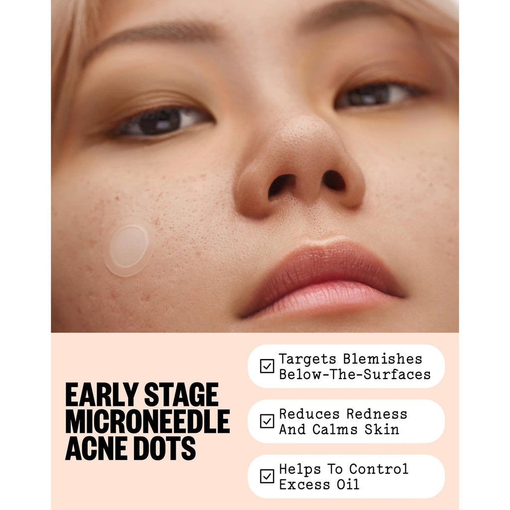 PEACE OUT Early Stage Acne Microneedling Hydrocolloid Dots (8 Count)