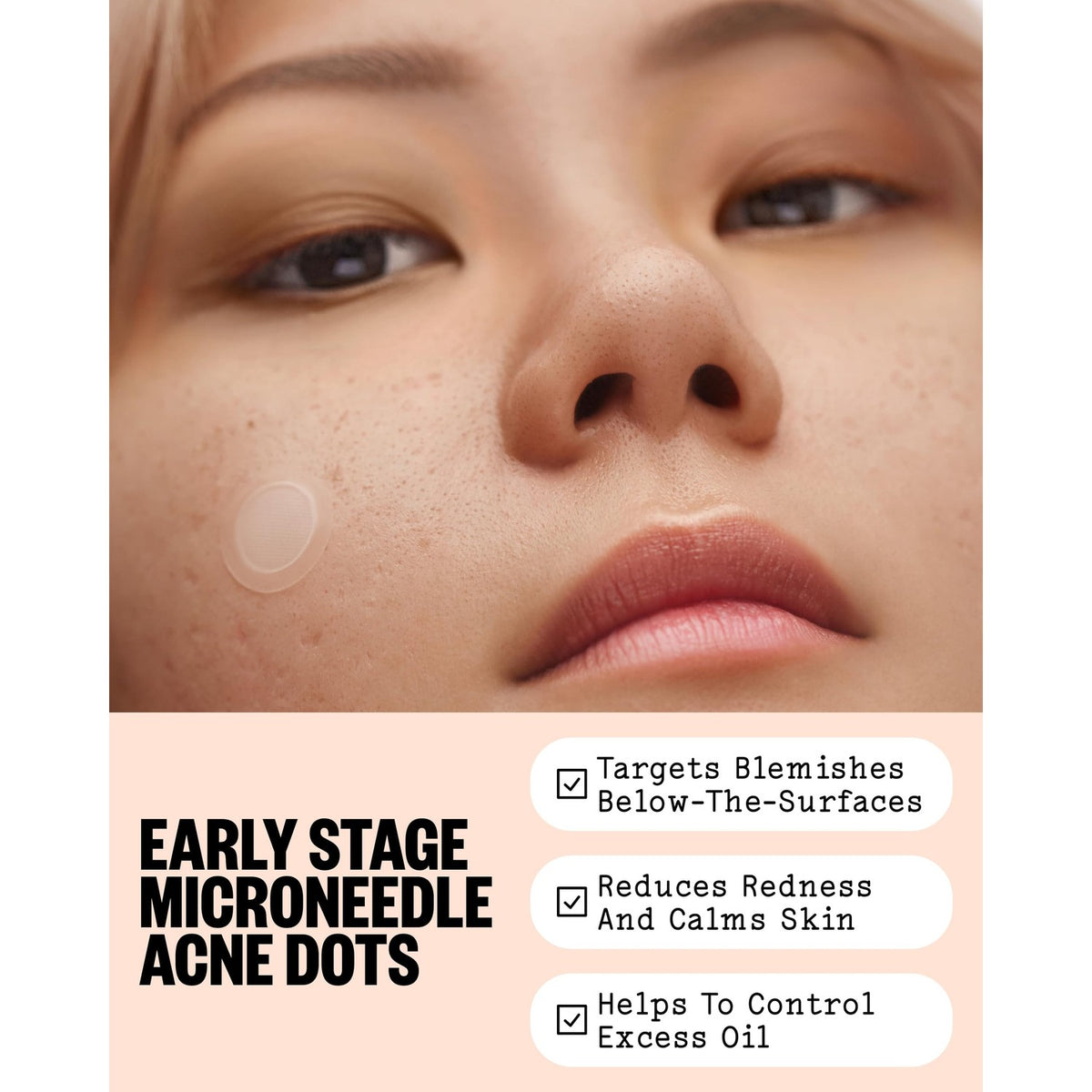 PEACE OUT Early Stage Acne Microneedling Hydrocolloid Dots (8 Count)