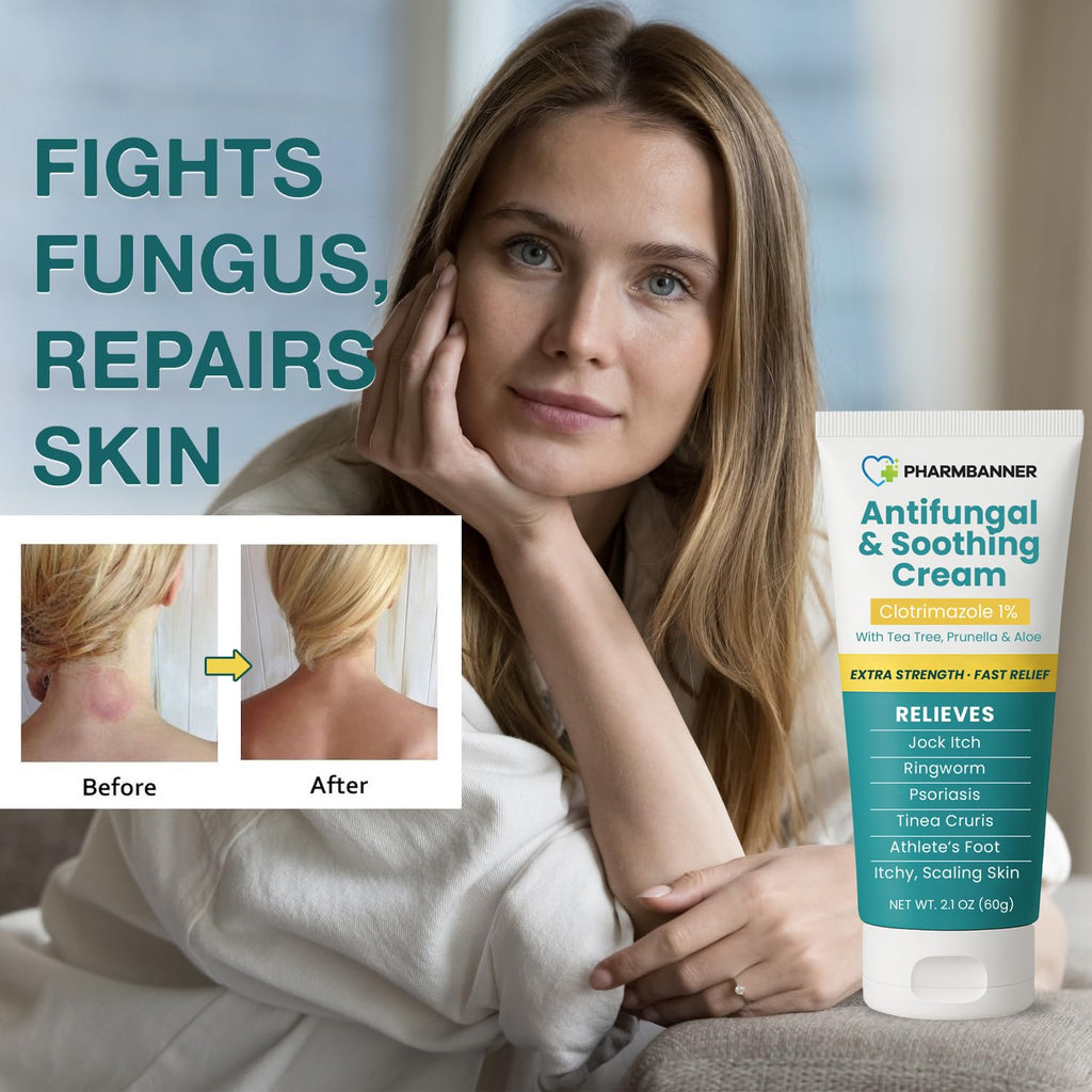 Antifungal Cream for Jock Itch, Ringworm, Psoriasis & Athlete’s Foot – Extra Strength Relief for Itchy, Burning Skin – Fast-Acting Formula for Tinea Cruris, Tinea Versicolor & Skin Irritations