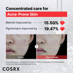 Buy now COSRX 15% Niacinamide Face Serum, 0.67 fl oz, Pore Minimizer Serum for Face, Even Skin Tone, Korean Skin Care at indiglob india