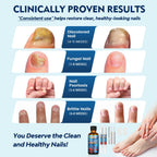 Toenail Fungus Treatment Extra Strength, Nail Fungus Treatment for Thick, Discolored Fungi Nails - 25% Undecylenic Acid All-in-One Kit with 30ML Fungi Nail Solution, 2 Nail Repair Pens