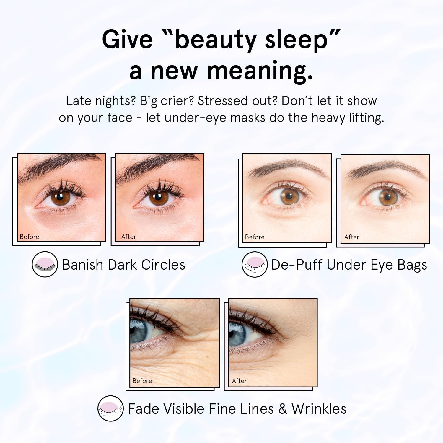 Buy now grace & stella Retinol Under Eye Patches for Puffy Eyes & Dark Circles - Restoring Gel Under Eye Masks with Hyaluronic Acid - Bridesmaid Gifts, Birthday Gifts for Women (Purple, 24 Pairs) at indiglob india