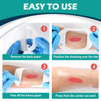 Transparent Film Dressing 6'' x 8'' Box of 12, Waterproof Bandages