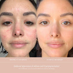 Buy now Summer Fridays CC Me Serum with Vitamin C + Niacinamide - Brightening + Hydrating Face Serum to Improve Skin Tone + Reduce Appearance of Dark Spots Over Time (1 Fl Oz) at indiglob india