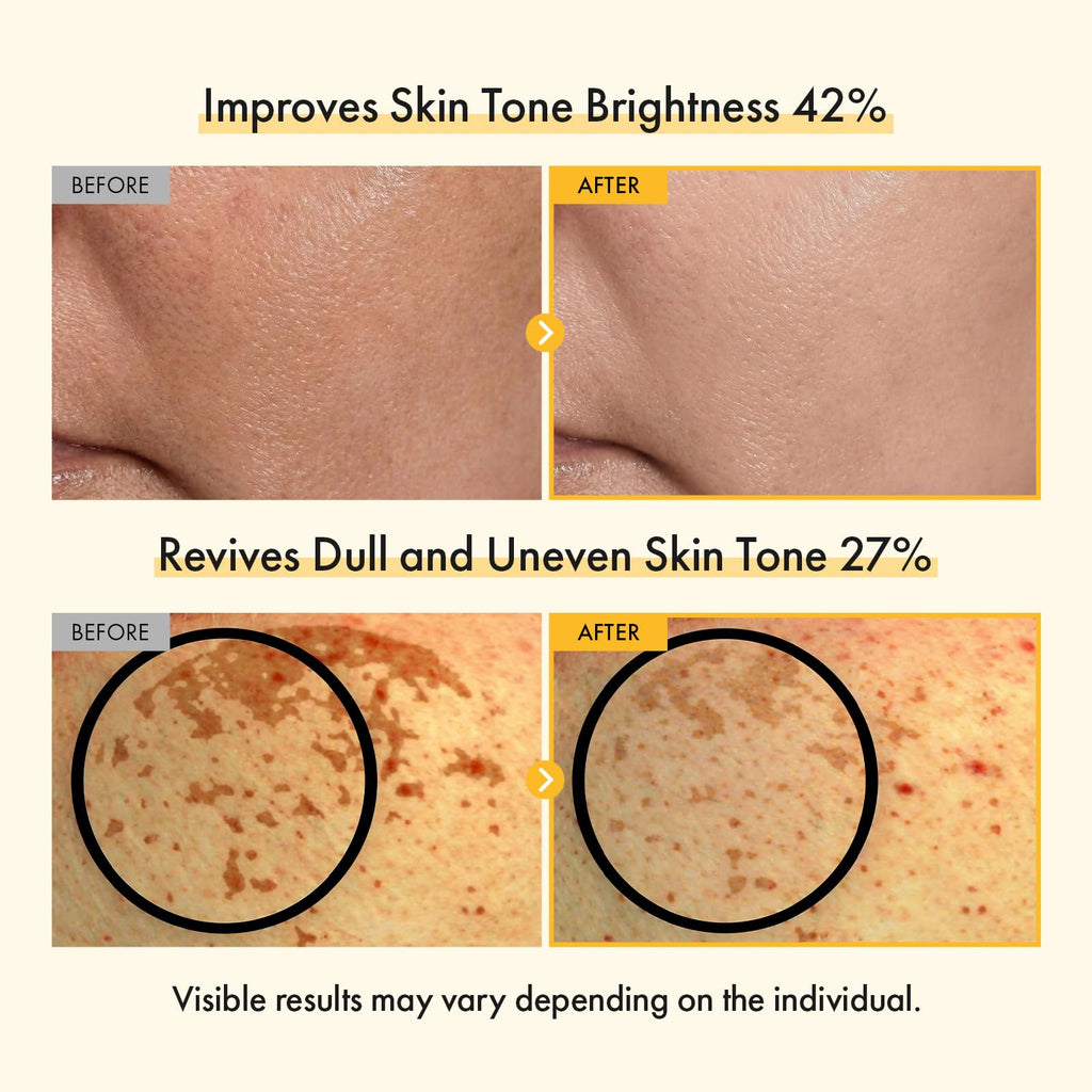 TOSOWOONG Vitamin C Brightening Cream for Even Tone & Dark Spots, Freckles