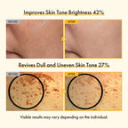 TOSOWOONG Vitamin C Brightening Cream for Even Tone & Dark Spots, Freckles