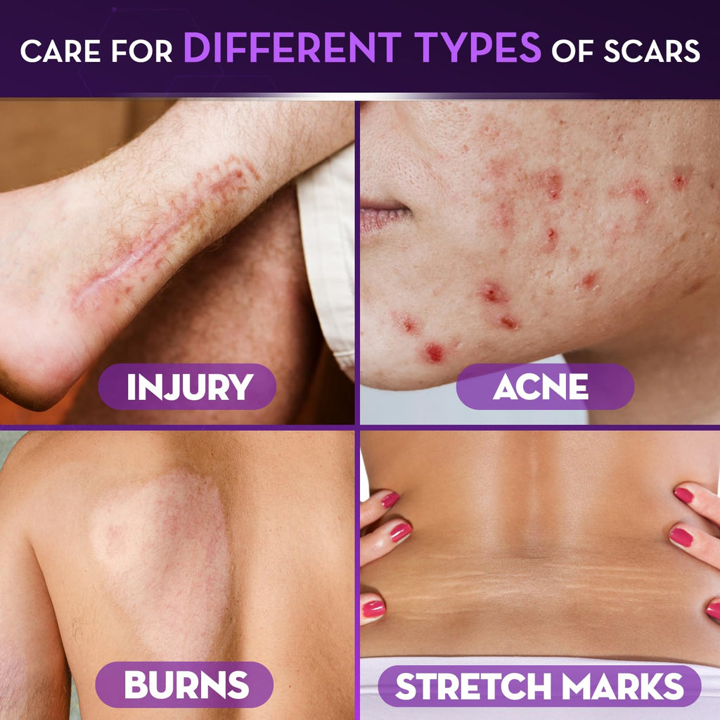 Buy now Cicatricure Advanced Scar Gel for Face & Body - Proven Results in 2 Weeks, Scar Treatment for Surgical Scars, Stretch Marks, Scars of Burns and Injuries, Acne Scar Treatment, 1 oz (28 g) at indiglob india
