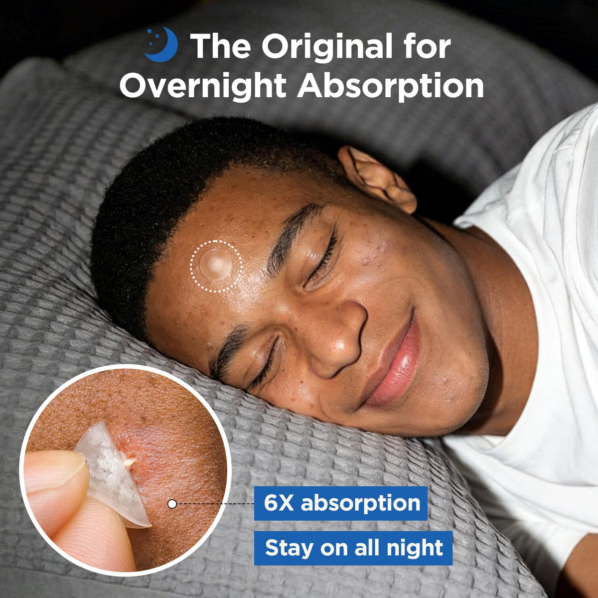 Invisible Pimple Patches for Face, Day & Night Acne Cover 330 Ct