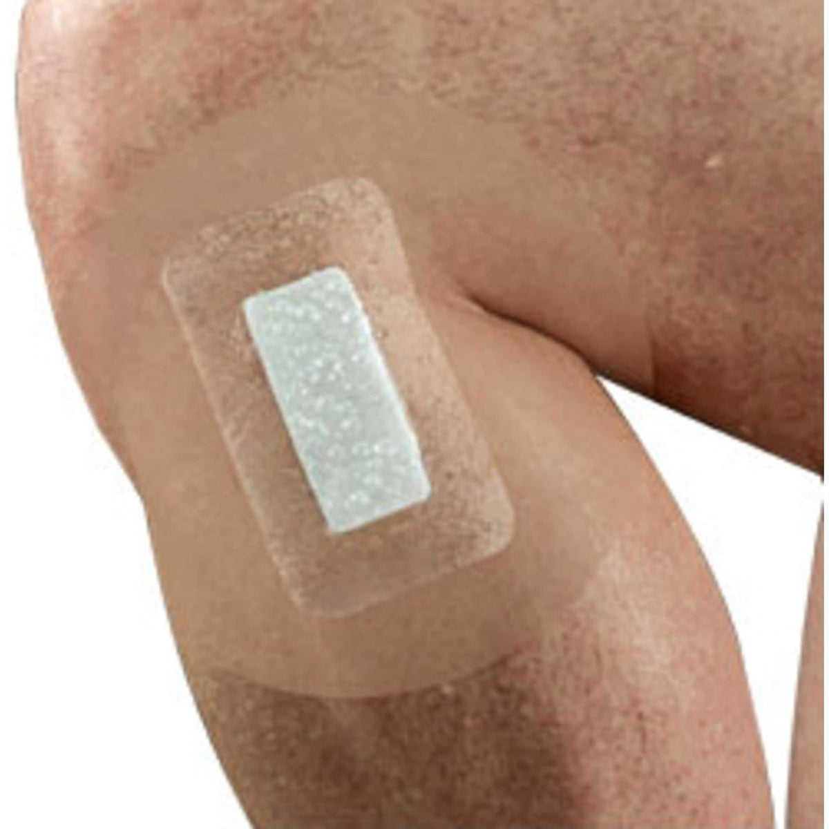 Nexcare Tegaderm + Pad Transparent Dressing, Clear Breathable Dressing Holds Fast for 7 Days, Waterproof for Safe Bathing - 5 Dressings