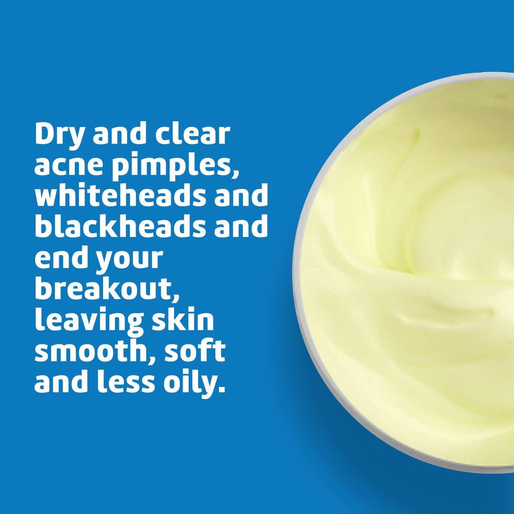 De La Cruz 10% Sulfur Ointment, Cystic Acne Treatment Face, Body 2.6oz jar | Maximum Strength Sulfur Acne Treatment, Helps Clear Pimples, Antibacterial & Anti-inflammatory, Non-Comedogenic, Made in USA