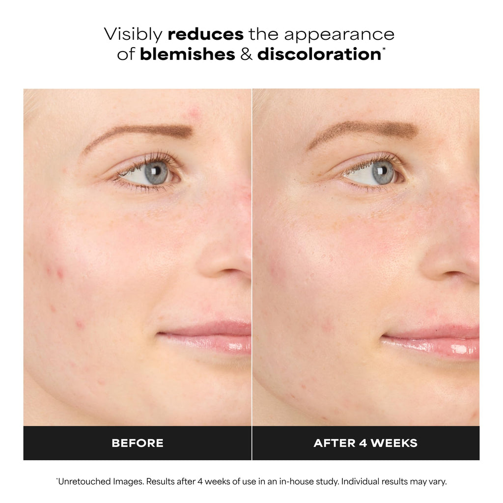 Paula's Choice BOOST 10% Azelaic Acid Booster Cream Gel Serum | Oil-Free Serum Fades Discoloration & Post-Blemish Marks with Licorice Extract & Salicylic Acid, Fragrance-Free