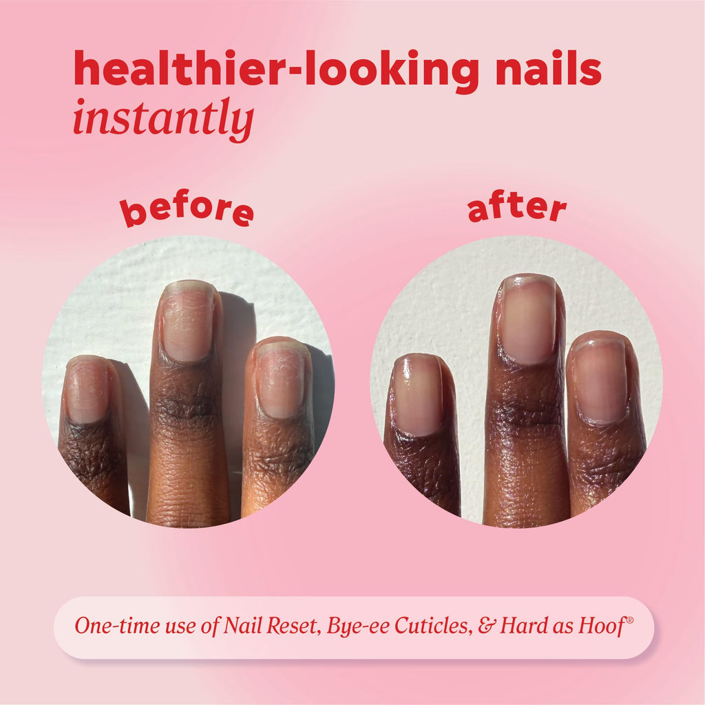 Onyx Professional Hard as Hoof Nail Strengthening Cream, Island Coconut Scent - Nail Growth and Conditioning Cuticle Cream Stops Splits, Chips, Cracks & Strengthens Nails, 1 oz