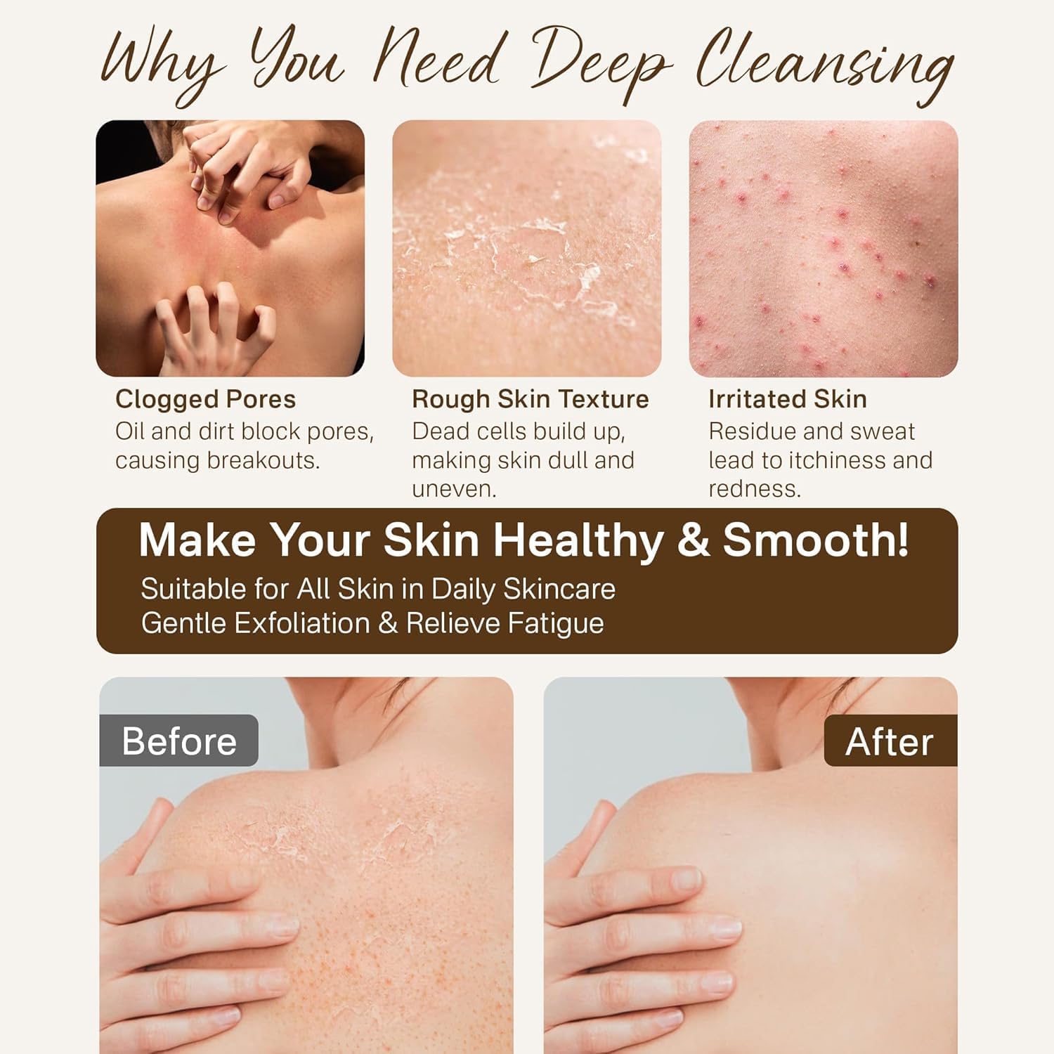 12 Pcs Exfoliating Gloves, Exfoliating Body Scrubber Exfoliator, Korean Exfoliating Mitt, Dead Skin Remover, Exfoliate Bath Shower Gloves, Moroccan Hand Body Scrub Mitt, Loofah Wash Cloth Washcloth | exfoliating