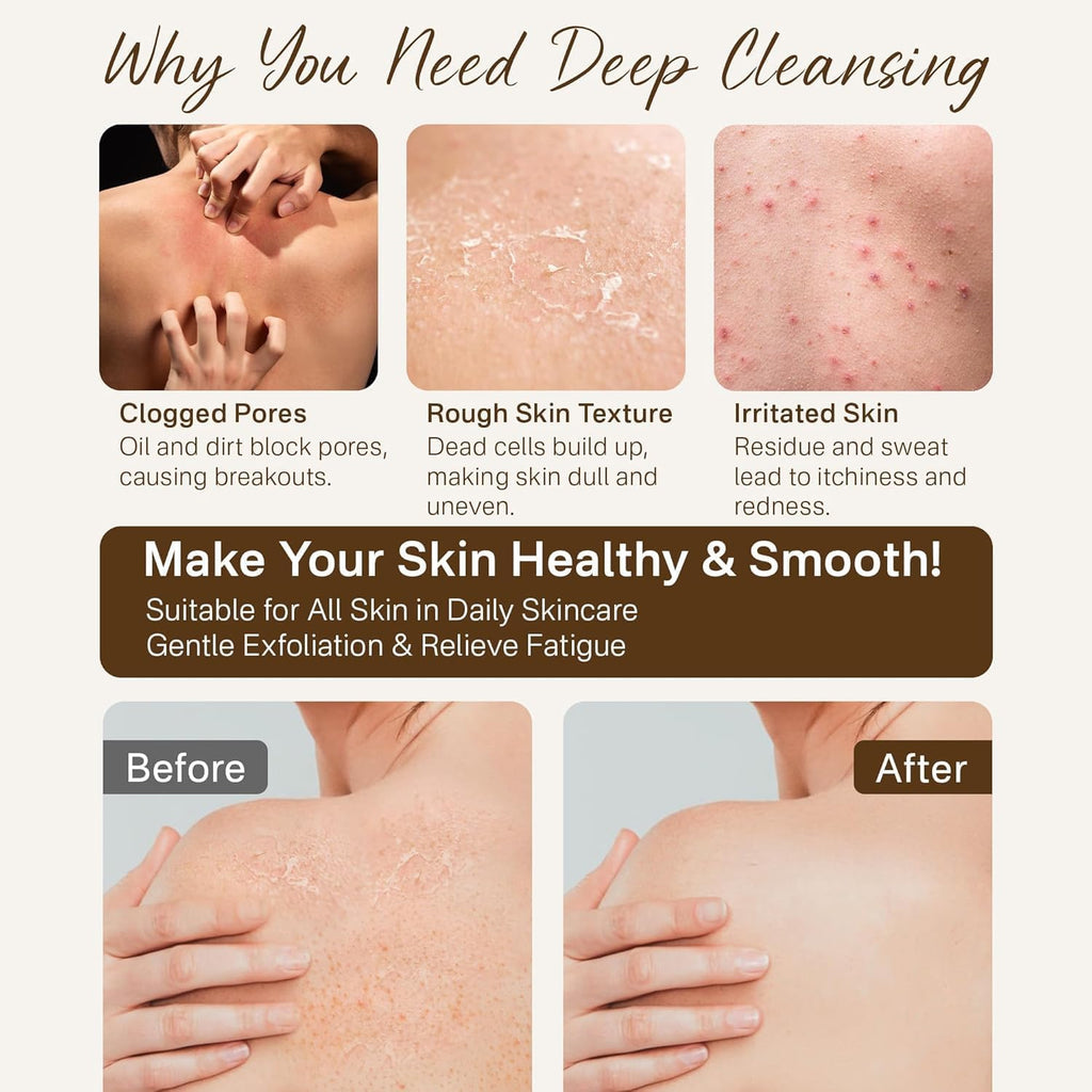 12 Pcs Exfoliating Gloves, Exfoliating Body Scrubber Exfoliator, Korean Exfoliating Mitt, Dead Skin Remover, Exfoliate Bath Shower Gloves, Moroccan Hand Body Scrub Mitt, Loofah Wash Cloth Washcloth | exfoliating