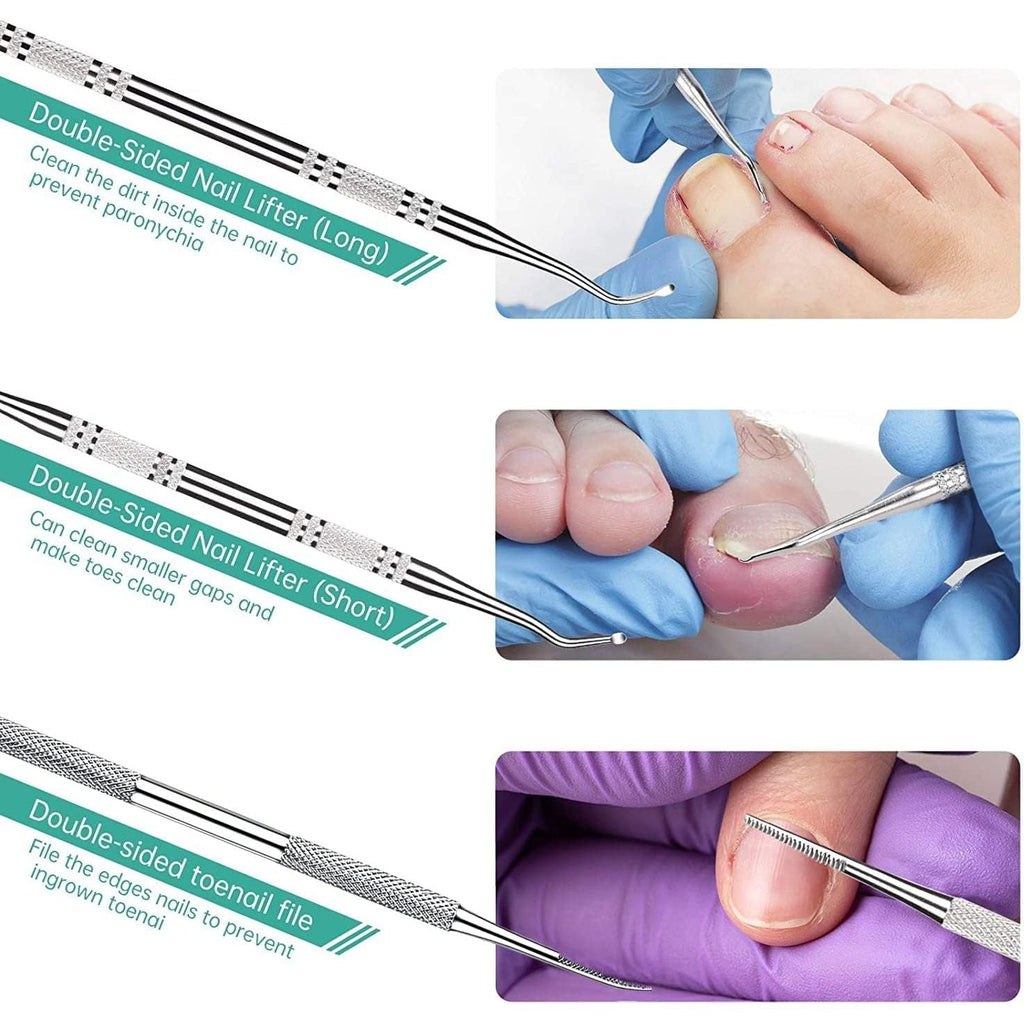 Buy now 3-Pack Ingrown Toenail File and Lifters, Professional Surgical Stainless Steel Ingrown Toenail Tool- Safe Nail Cleaning Treatment Pedicure Tools Kit Under Sidewall Cleaner Pain Relief Accessories at indiglob india