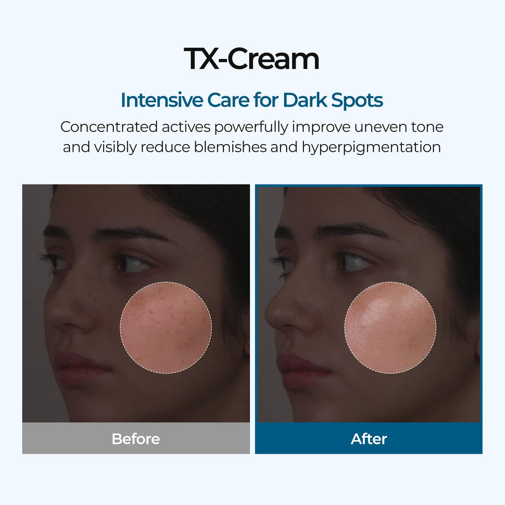 DR.Melaxin TX Tranexamic Acid CREAM | Skin freckle Cream, Blemishes, Anti-pigmetation korean skin care | Korean Cosmetics | 1.7 fl oz (50 ml)