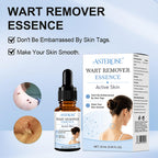 Mole & Wart Remover for Face & Body, Fast-Acting Freeze-Off