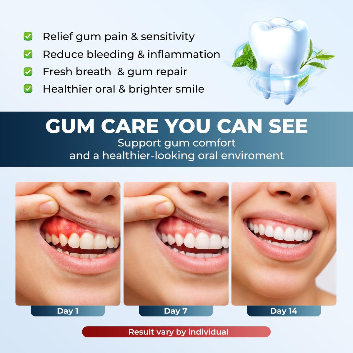 Red Light Therapy for Gums, KTS Oral Care Light with Smart Controller, Red & Blue LED for Gum Health, Toothache Relief, Repair Bleeding Sensitive Gums, Detachable Mouthpiece for Easy Cleaning