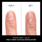 butter LONDON Cuticle Remover Liquid, Melt Away, Manicure and Pedicure Prep