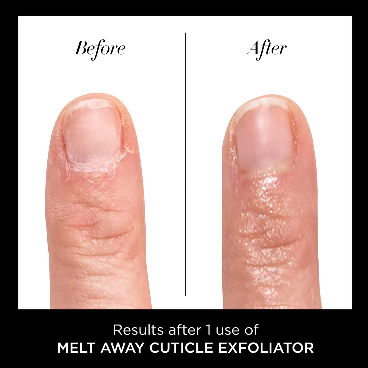 butter LONDON Cuticle Remover Liquid, Melt Away, Manicure and Pedicure Prep