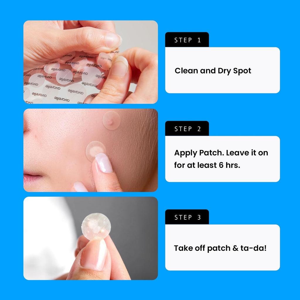 Buy now AVARELLE Acne Cover Patches, Eligible Hydrocolloid Pimple Patches for Face with Tea Tree Oil, Korean Skincare Zit Patches for Face | HSA Store Eligible Items | Vegan, Cruelty-free at indiglob india