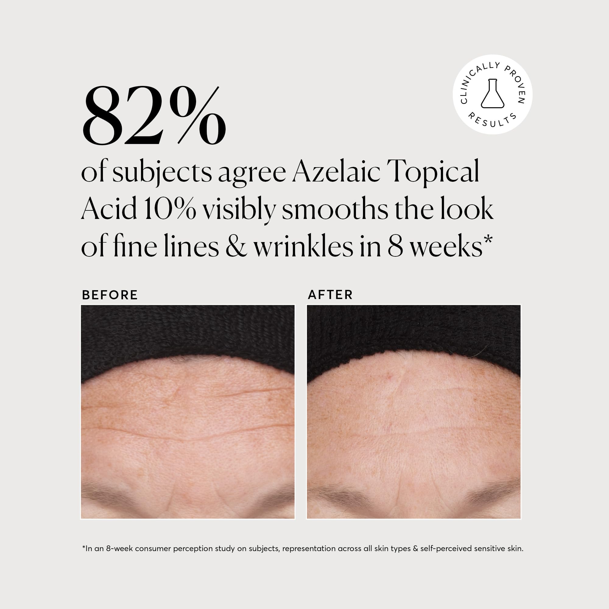Buy now Naturium Azelaic Topical Acid 10%, Face & Skin Care Beauty Treatment with Niacinamide & Vitamin C, 1 oz at indiglob india
