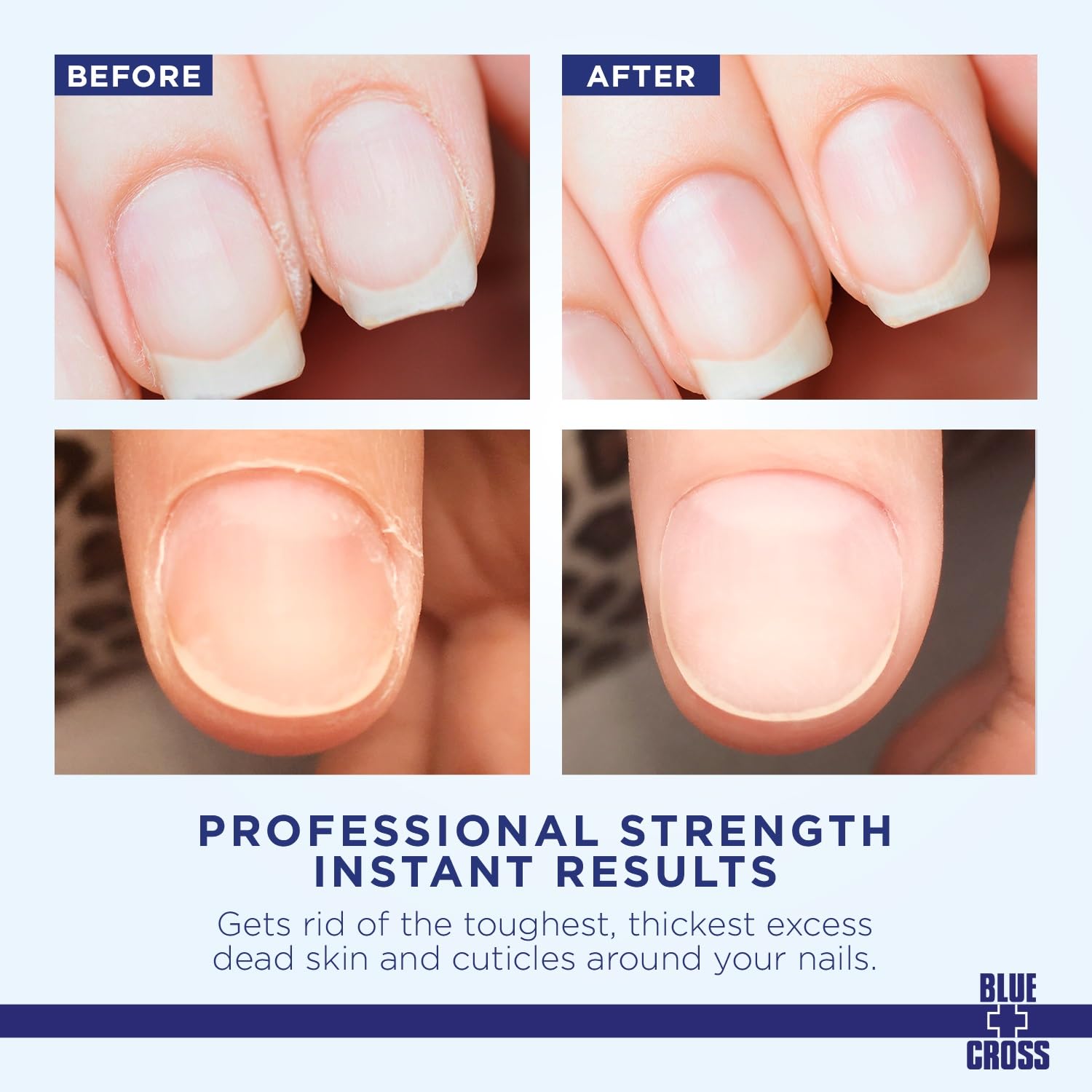 Blue Cross Cuticle Remover & Softener with Lanolin for Nails, 6 oz | Hydrating Treatment for Dry Cuticles & Hangnails, Milk Beauty, 100 Acetone Manicurist Nail Acetone, Soaking Nail Protein Bond
