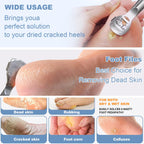 36 Pcs Callus Shaver for Feet Set, (1Stainless Foot File &1 Foot File Heads & 30 Replacement Slices Blades & 4 Pedicure Knife), Professional Callus Remover for Feet Tools for Wet and Dry Feet