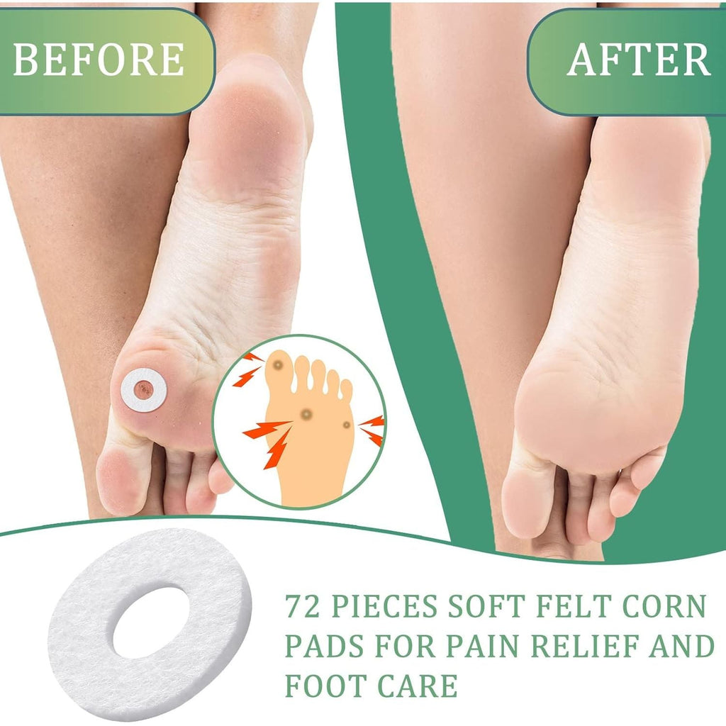 Buy now Nuanchu 72 Pcs Callus Cushions Callus Pads for Bottom of Foot Round Corn Cushions Pads for Feet Soft Adhesive Felt Corn for Ball and Side of Foot, Pain Relief from Shoe at indiglob india