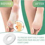 Buy now Nuanchu 72 Pcs Callus Cushions Callus Pads for Bottom of Foot Round Corn Cushions Pads for Feet Soft Adhesive Felt Corn for Ball and Side of Foot, Pain Relief from Shoe at indiglob india