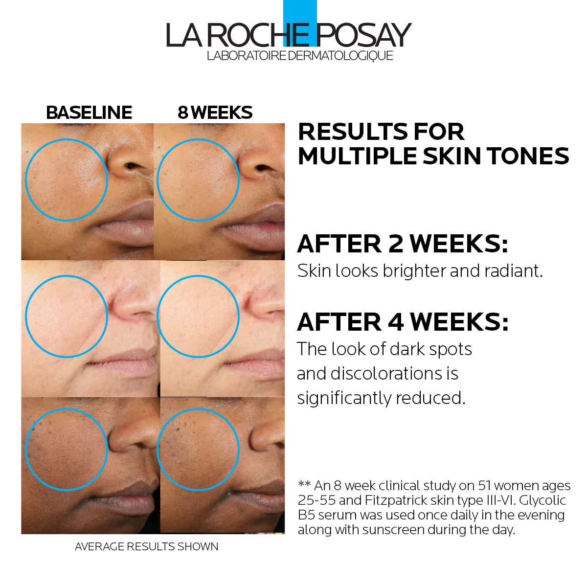 Buy now La Roche-Posay Glycolic Acid Serum with Kojic Acid and Vitamin B5, Reduces Dark Spots and Discoloration, Skin Tone Corrector to Brighten and Even Skin Tone at indiglob india