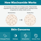 Paula's Choice Niacinamide Face Toner, Combination or Oily Skin | Niacinamide Toner for Combination & Oily Skin, Minimizes Large Pores, Controls Oil & Shine