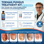 Toenail Fungus Treatment Extra Strength, Nail Fungus Treatment for Thick, Discolored Fungi Nails - 25% Undecylenic Acid All-in-One Kit with 30ML Fungi Nail Solution, 2 Nail Repair Pens