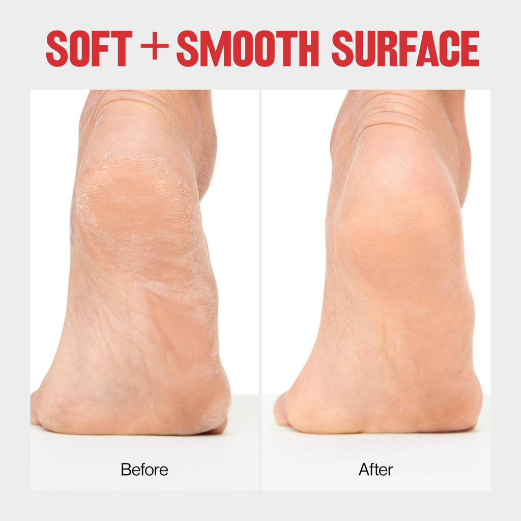 Buy now Revlon Callus Remover, Foot File for Wet or Dry Skin, Pedicure Tools,Gently Removed Callus and Dead Skin, Easy to Use (Pack of 1) at indiglob india