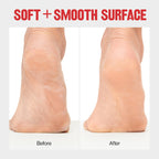 Buy now Revlon Callus Remover, Foot File for Wet or Dry Skin, Pedicure Tools,Gently Removed Callus and Dead Skin, Easy to Use (Pack of 1) at indiglob india