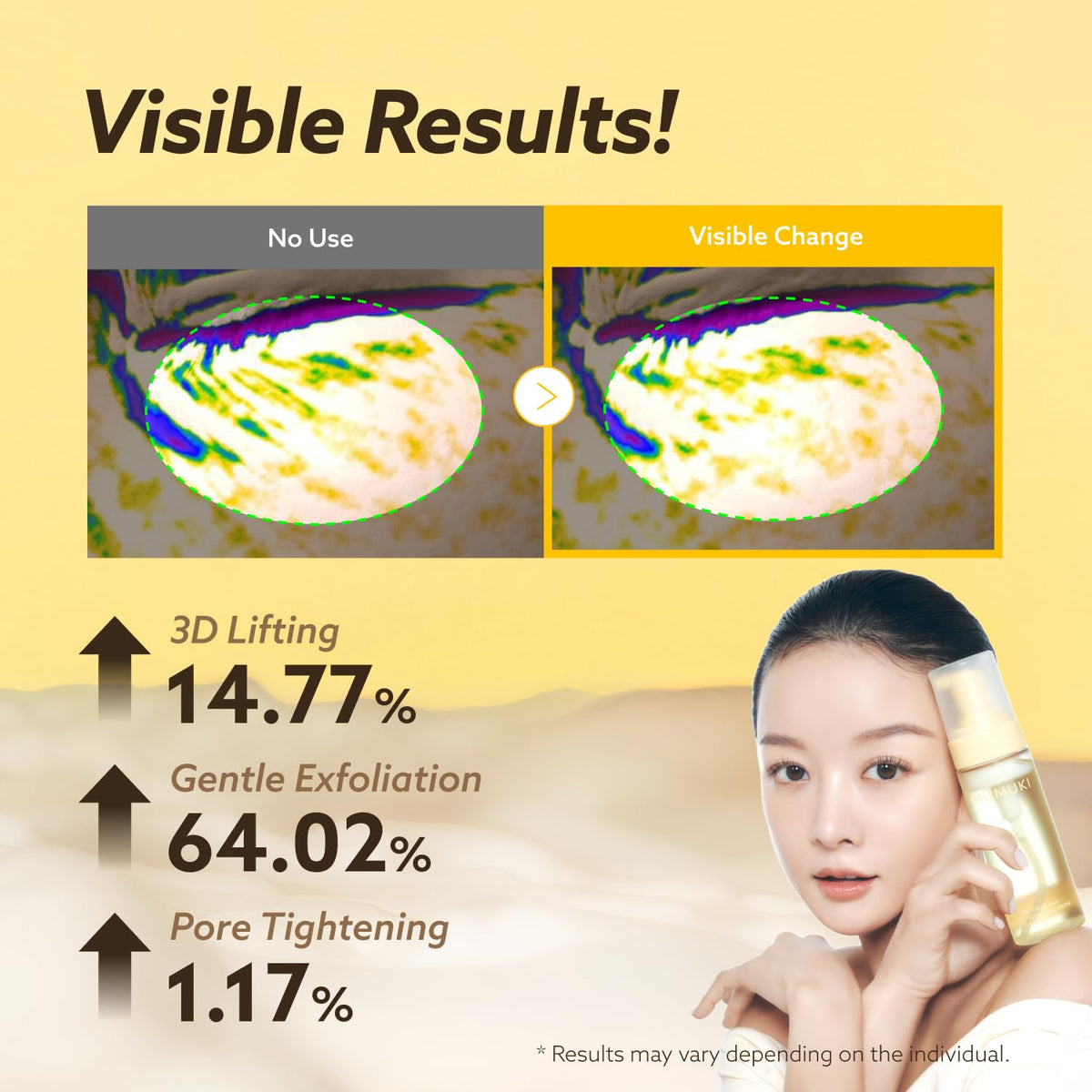 Honey Banana PDRN Bubble Toner | No-Rinse Korean Toner with Plant PDRN, Retinol, Panthenol & Hyaluronic Acid | Hydrating Exfoliating Bubble Mask for Glass Skin Glow | BDRN K-Beauty, 5.07 fl oz